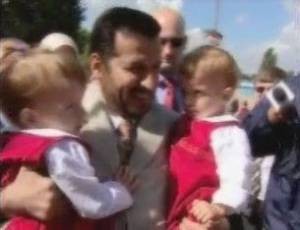 Profesor Abdullah Al Rabeeah u syjamskich bliźniaczek z Janikowa