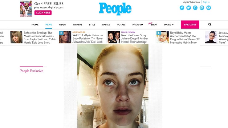 Amber Heard udostępniła kolejne zdjęcia. Podtrzymuje, że Johnny Depp ją bił