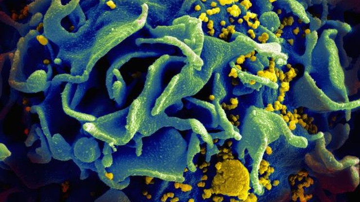 W Rosji nawet 1,5 miliona osób może być zakażonych HIV