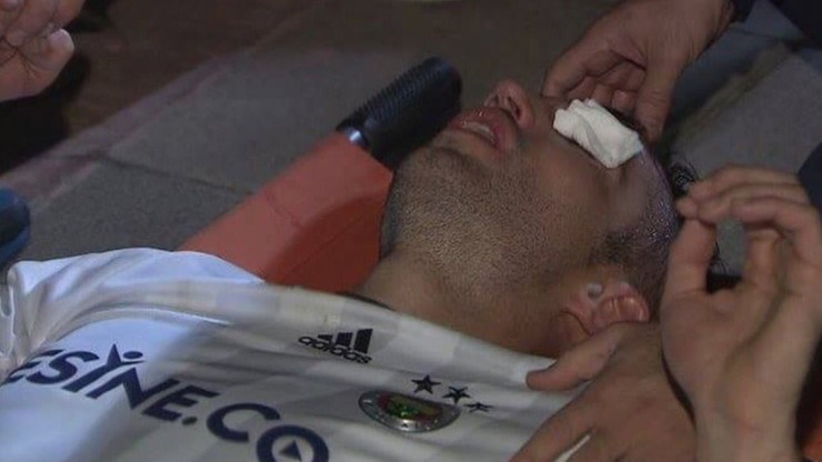 Van Persie stracił wzrok na meczu?! Fatalna kontuzja oka